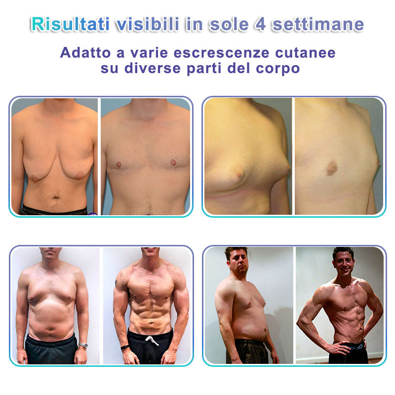 🌊GFOUK® NanoMedix Patch Ginecomastia - Azione Brucia Grassi e Tonificante