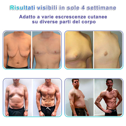 🌊GFOUK® NanoMedix Patch Ginecomastia - Azione Brucia Grassi e Tonificante